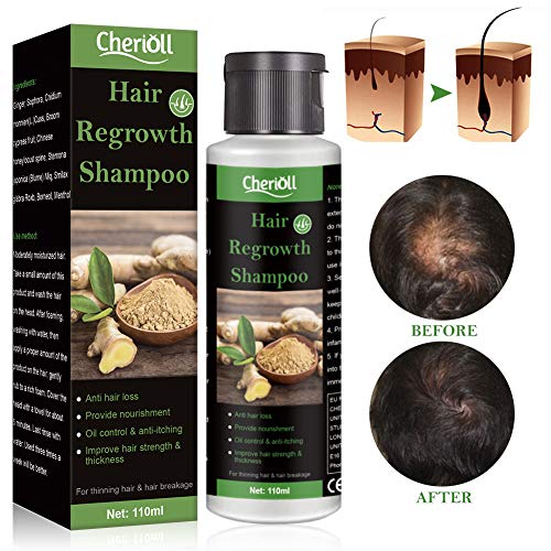 Hair Loss Shampoo, Hair Growth Shampoo, Anti-Hair Loss, Extra Strength Hair Growth Treatment, Treated Hair Care for Thinning Hair, Natural Hair Regrowth For Men & Women, Grow Hair Faster