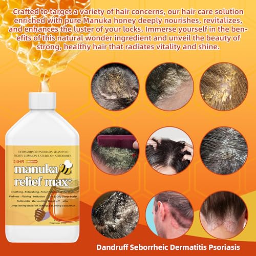 6-Pack-Manuka-Honey-Shampoo-Folliculitis-Shampoo-Seborrheic-Shampoo-Anti-Dandruff-Fast-Acting-Shampoo-Folliculitis-Dandruff-Scalp-Psoriasis-Relieve-From-Itchy-and-Dry-Scalp-Soothing-Scalp