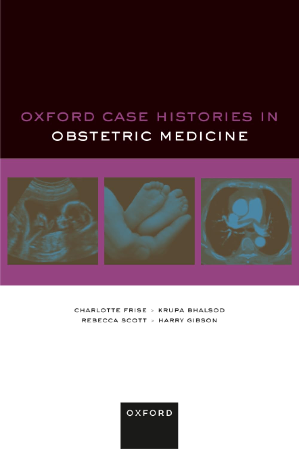 Oxford Case Histories in Obstetric Medicine by Charlotte Fris... - 9780192845894