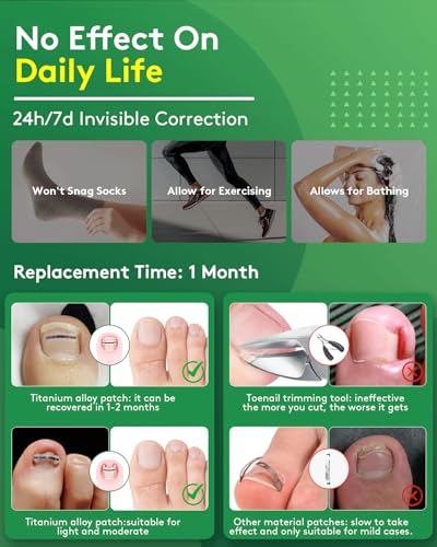 Ingrown Toenail Treatment Kit - Titanium Alloy Nail Corrector Tools, Quick Relief & Long-term Correction Patch for Ingrown Nails, Solution for Curved Toenail Repair & Removal (0.51/0.59/0.67/0.79in) - Thumbnail 6