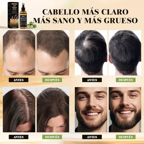 Sérum Spray Cabello Hombres/Mujeres,Previene la Caída,con Aceite de Romero,Aceite de Ricino y Biotina,Promueve el Crecimiento del Cabello y de la Barba,SuavePara Todo Tipo de Cabello,60 ml - imagen 4
