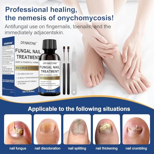 Toenail Fungus Treatment Extra Strength with 25% Undecylenic Acid, Ingrown toenail treatment, nail repair, Fungus nail treatment, yellow toenail, Damaged Nails foot fungus treatment extra strength
