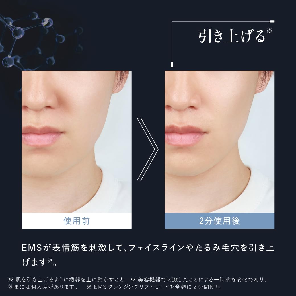 Amazon | ディズム EMSポアディープクリア＆リフトブラシ+クリーミー