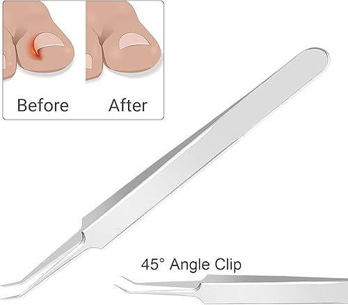 Miniatura 5 de Cortaúñas de hoja recta para uñas encarnadas y gruesas, cortaúñas de hoja recta para eliminación de uñas encarnadas y gruesas, incluye pinzas, lima