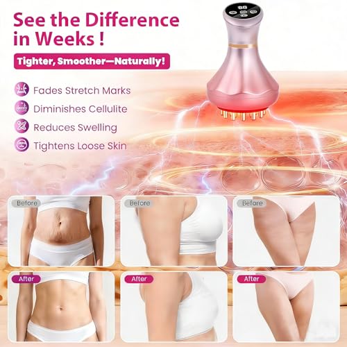 Image of 4-in-1 Lymphatic Drainage Massager - Anti-Cellulite Tool with Heating /Vibration /Light Therapy, Cordless Handheld for Sciatica & Legs /Belly /Back /Hips Pain Relief & Skin Tightening