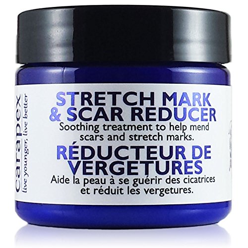 Carapex Stretch Mark & Scar Reducer Cream - 98% Natural, for Pregnancy Marks, Weight Loss Marks, Tightening, Firming, Unscented with Shea Butter, 4oz