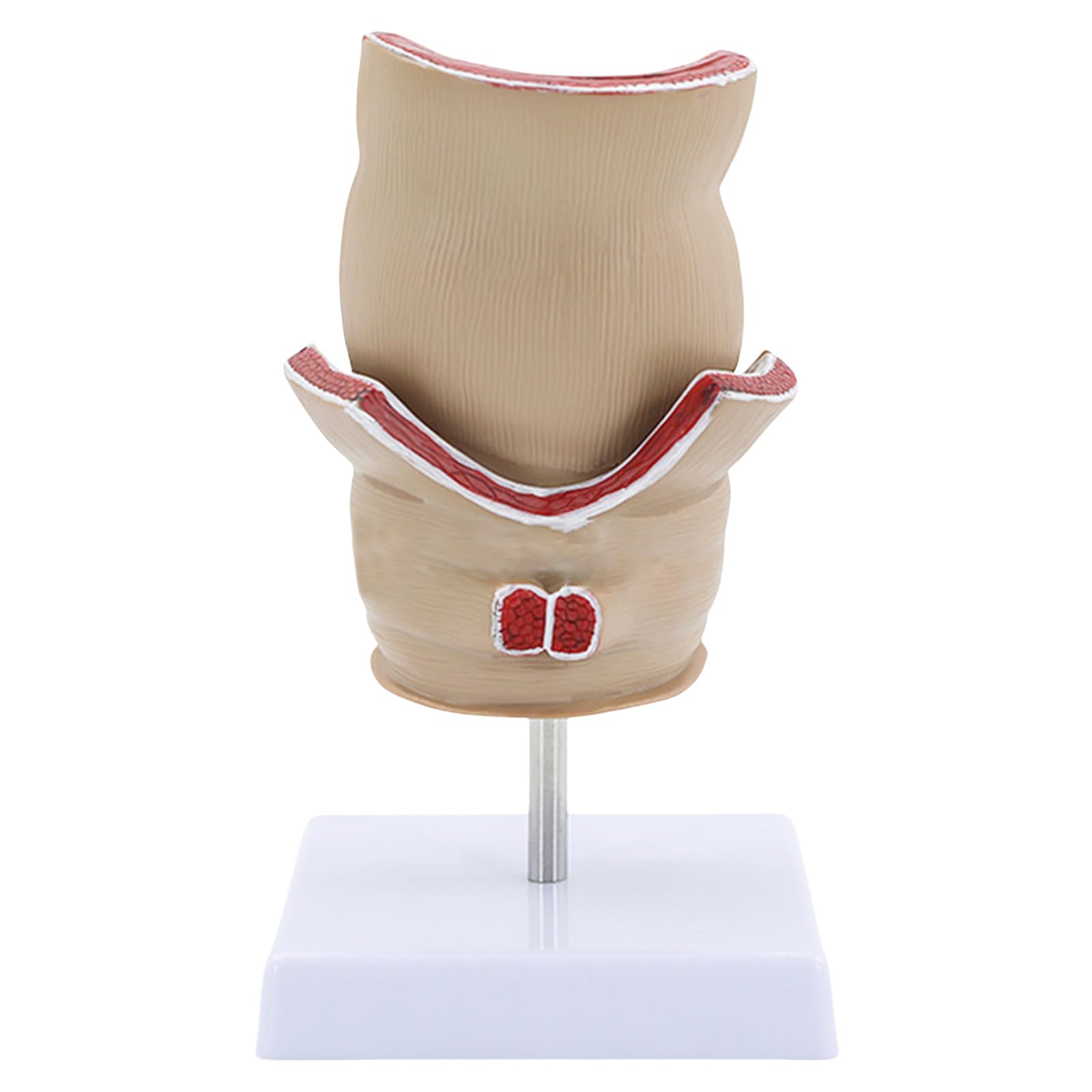 Xiaoxu Modèle de Rectum pour travaux Pratiques en Anatomie Humaine : Pathologies du Rectum, Outil pédagogique en Anatomie.