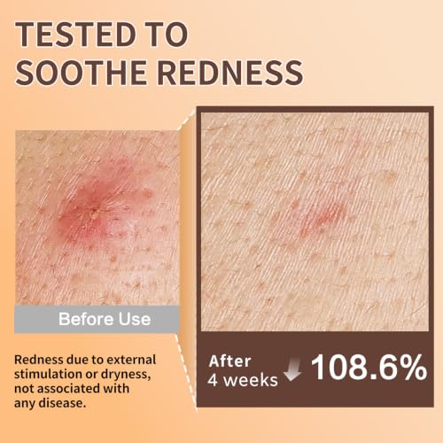 ABOTE Snail Mucin Face Serum 120ml with 96% Snail Secretion Filtrate — view 3