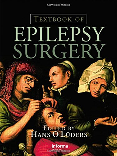 Textbook of Epilepsy Surgery