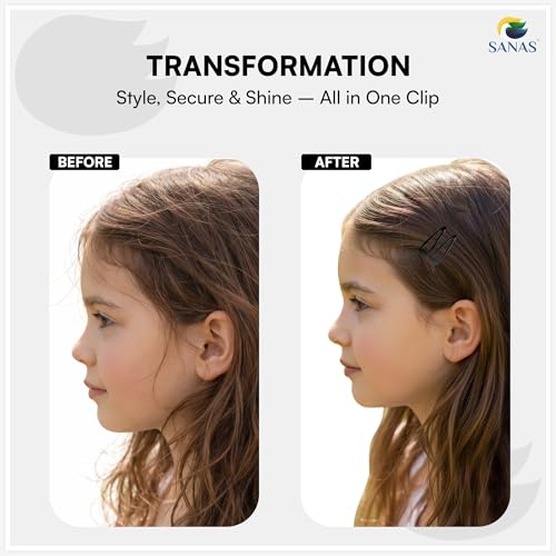 Image of Sanas Tic Tac Hair Clips For Women (30 Pcs) Black Metal Tic Tac Hair Clips, Snap Hair Clip For Women & Girls Strong Snap Lock Hair Pins For Styling, Everyday Hair Accessories For Kids (Black) (30 Pcs)