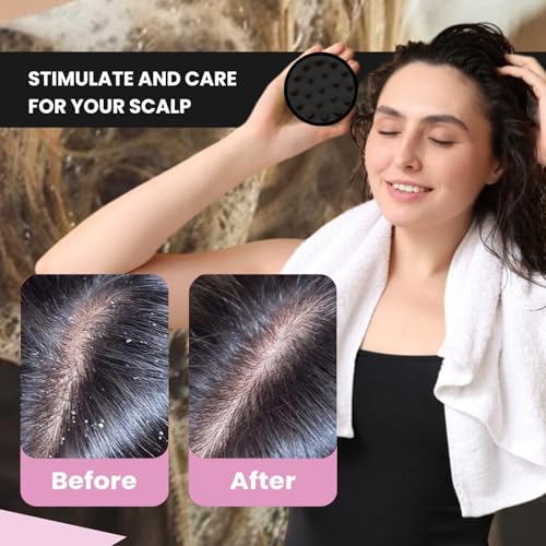 Image of MildCares Scalp Massager Brush - Silicone Scalp Exfoliator & Anti‑Dandruff Scrubber | Head Massager for Hair Growth, Shampoo Applicator & Oil Massage | Waterproof, Non‑Slip Grip | For Men & Women (Black, Pack of 1)