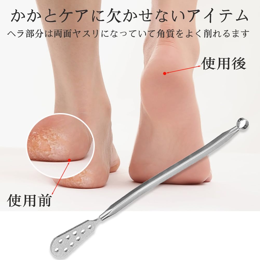 Amazon | Forahome 角質リムーバー 角質取り 足 2in1機能 タコ 角質