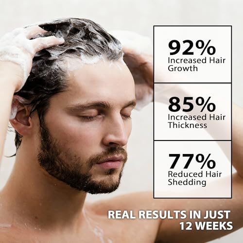 Image of Root Activator Shampoo for Men-Hair Growth Shampoo for Hair Loss and Thinning Hair,Sulfate Free-13.6 fl oz / 400 mL