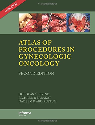Atlas of Procedures in Gynecologic Oncology, Second Edition | Amazon.com.br
