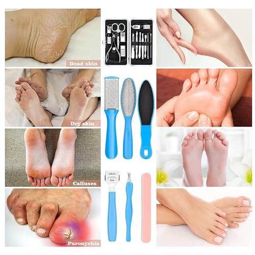 Image of Kamz Pedicure Kits - Callus Remover for Feet, 23 in 1 Professional Manicure Set Pedicure Tools Stainless Steel Foot Care, Foot File Foot Rasp Dead Skin for Women Men Home Foot Spa Kit, Blue
