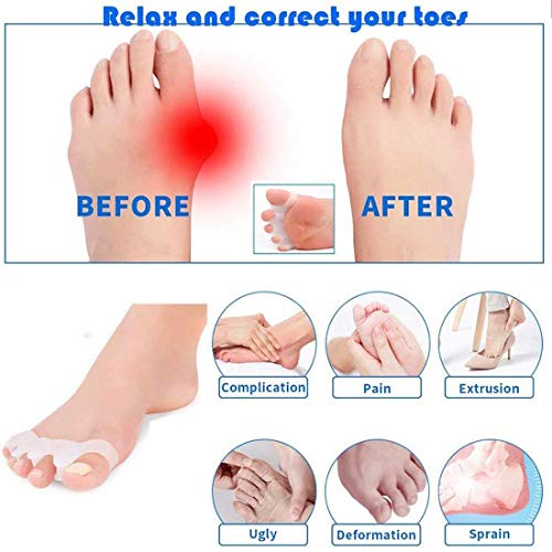 Image of 2 Pair Kids Toe Separators - Soft Gel Foot Spacers for Correcting Bunions, Hammer Toes, Relieving Foot Pain & Plantar Fasciitis