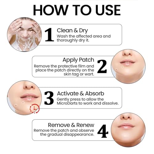 Image of Derma Smooth Skin Tag Removal Patches - 144 Patches | Gentle & Effective Skin Tag Remover for All Skin Types | No Burning or Freezing, Fast and Effective Results, No Scarring | Easy & Pain-Free Application-(Transparent & BOX PACKED)
