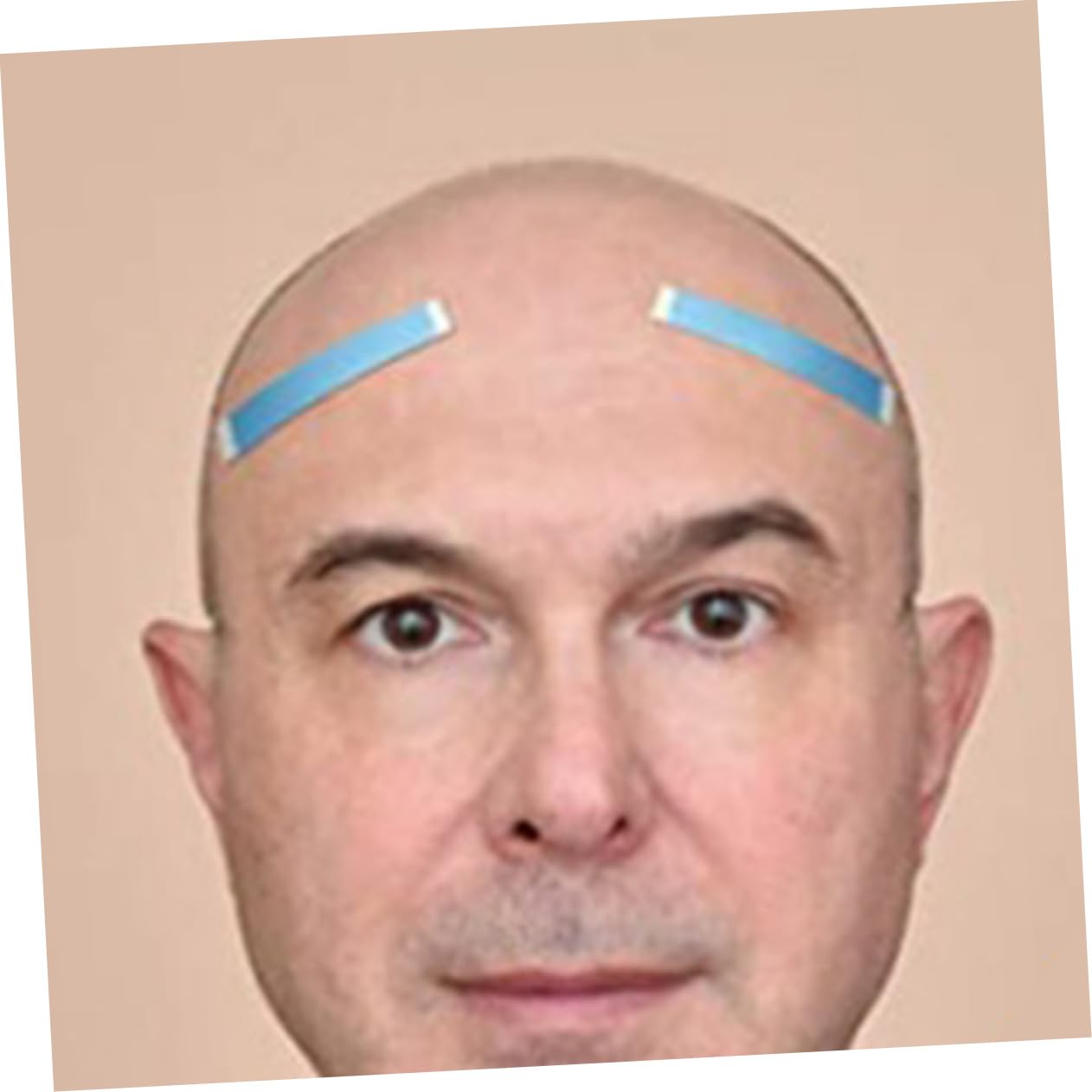 Baluue Effortless Wig Installation Kit 12pcs Double-Sided Lace Wig Tape for Hair Extensions