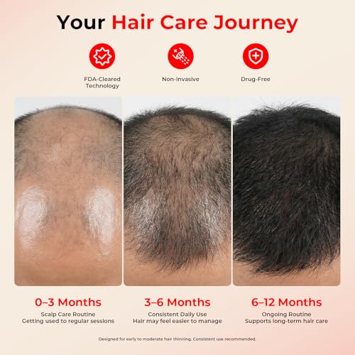 Image of CAYAMA Red Light Hair Growth Cap for Men & Women, 528 Total Light Emitters | Full-scalp coverage with adjustable fit, 10-30 min remote sessions, adapter or compatible power bank support