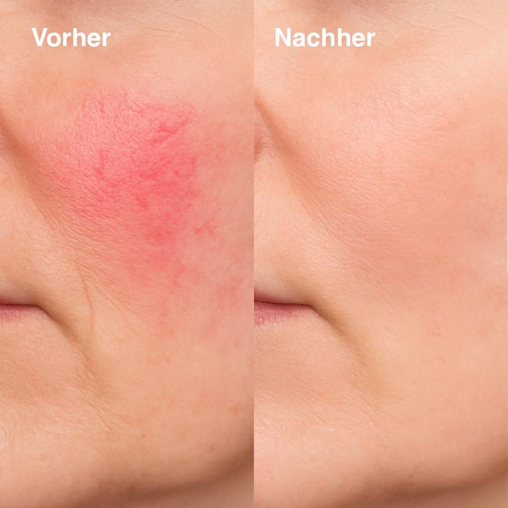 KU2 LED Gesichtsmaske mit 7 Lichtmodi – 180 LEDs für Anti Aging – Reduziert Falten, Akne & Rosacea – Lichttherapie Maske – Rotlichtmaske für zu Hause