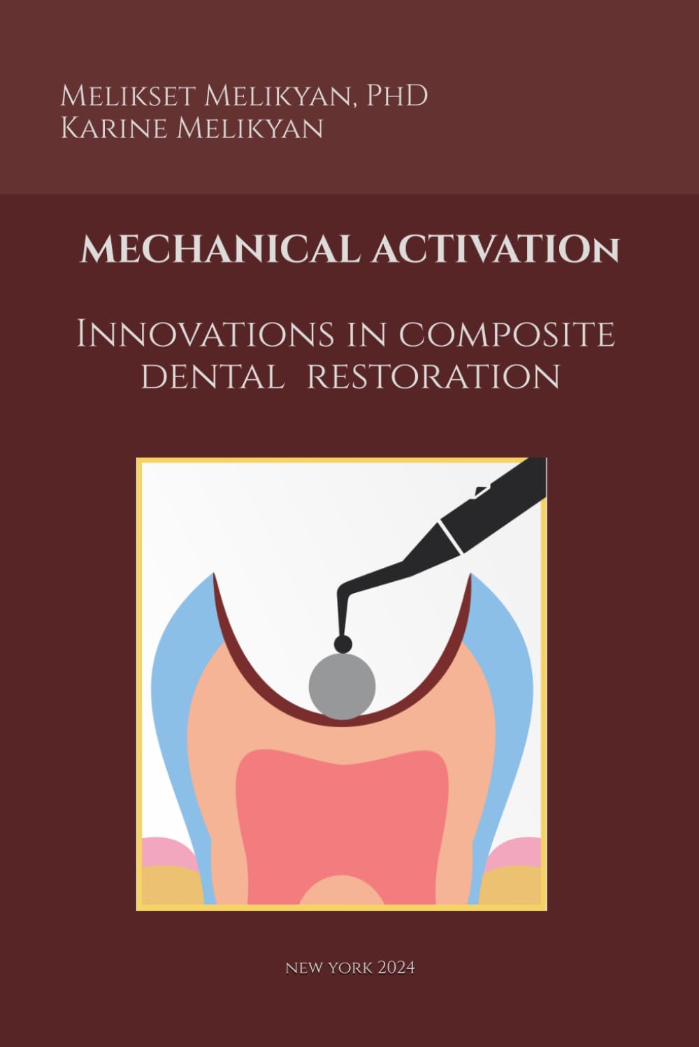 MECHANICAL ACTIVATION: Innovations in Composite Dental Restoration