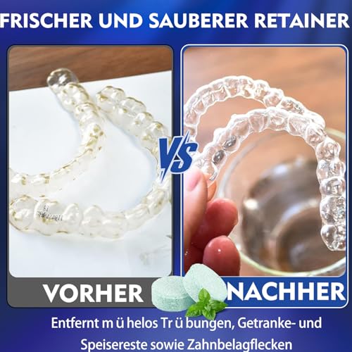 Retainer Reinigungstabletten,1 Monat Vorrat Gebissreiniger Tabs, Zahnspangenreiniger, Zahnschienen Reiniger,Entfernt Flecken & Gerüche, für Retainer, Zahnersatz, Mundschutz, Zahnspangen, Nachtschienen