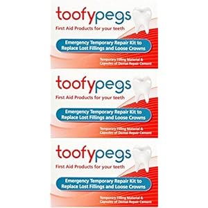 Toofypegs Noodreparatie voor vullingen en Crowns x 3 verpakkingen door Toofy Pegs