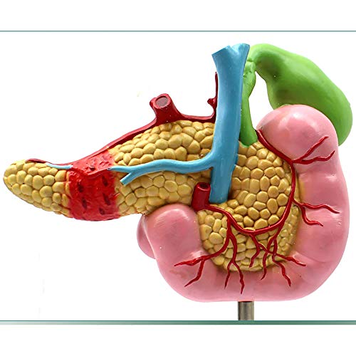 Modèle anatomique du pancréas pour expliquer les pathologies aux patients - 8