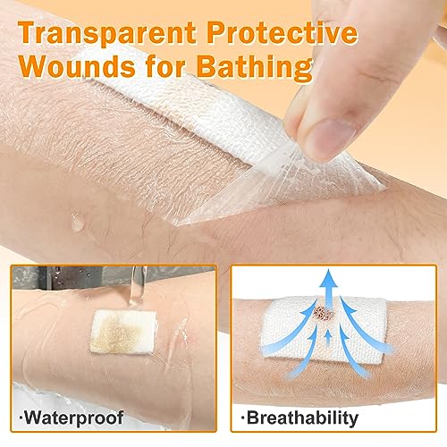 Image of Carbou Transparent Film Dressing, 2.36 inch x 2.75 inch, Pack of 100