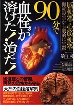 止血・血栓ハンドブック 血栓をつくらない! (TJMOOK) | 板倉 弘重 |本 | 通販 | Amazon