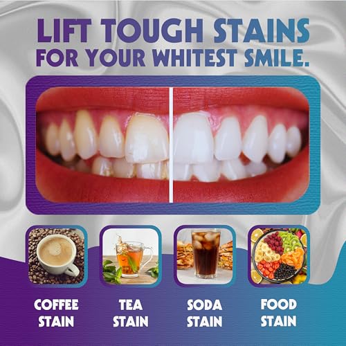 Whiten'Em Whiten’Em Teeth Whitening Strips For Sensitive Teeth 14 Treatments (28 Strips) Peroxide Free thumb #3