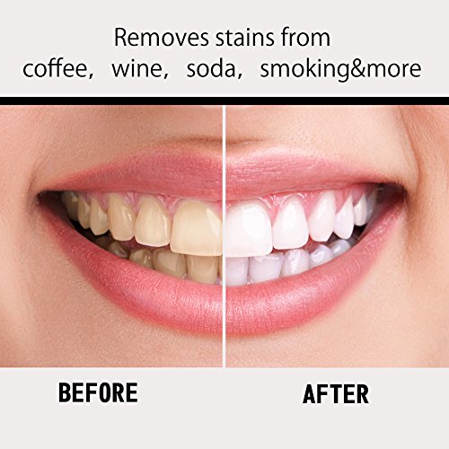 Higiene Bucal Y Dental, Drugstore tiras blanqueadoras Marca TMISHION (3)