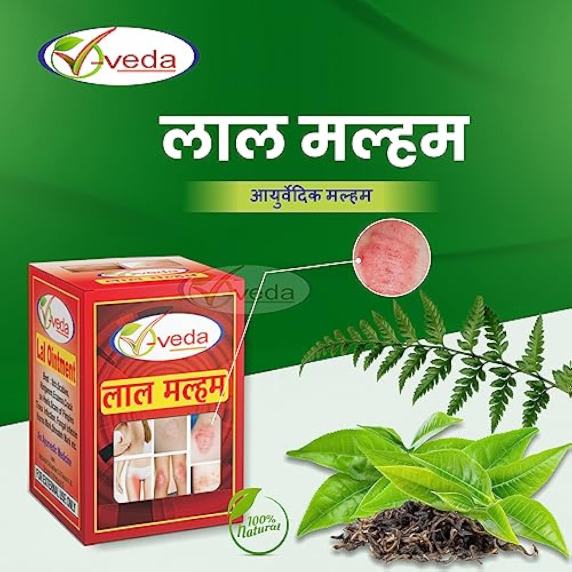 V Veda Lal Ointment Pack of 5, Herbal Health Product