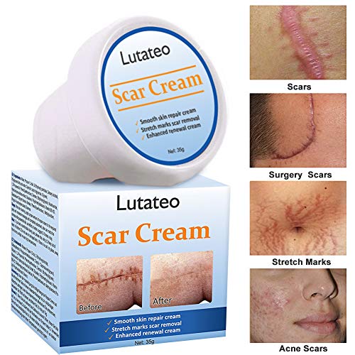 scar gel for stretch marks
