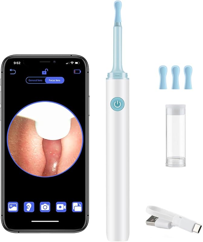 LANMOU Fülzsír Eltávolító Otoszkóp Kamerával, 1080P HD Fültisztító 6 LED Világítással, 4 Szilikon Kanállal, IP67 Vízálló iPhone Android iPad