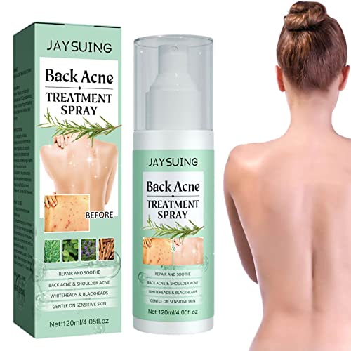 Aibyks Solución para espinillas en la Espalda | Espray para el Cuidado de la Piel de la Espalda, espray reparador de hinchazón, 4.22 FL oz - Espray de eliminación de espinillas