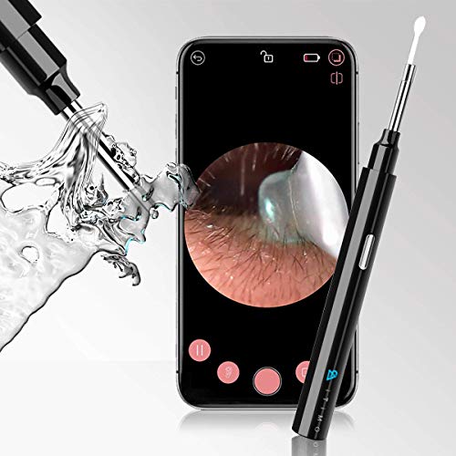 CHARMINER Ear Wax Removal Endoscope, Ear Wax Removal, 1080P Wireless Ear Camera with 6 LED Lights, Ear Endoscope for Family