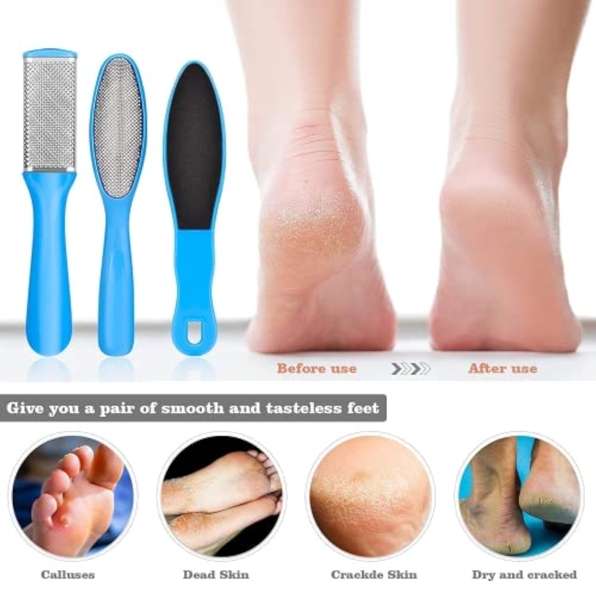8 in 1 Pedicure Kit, Foot Scrubber & Tools