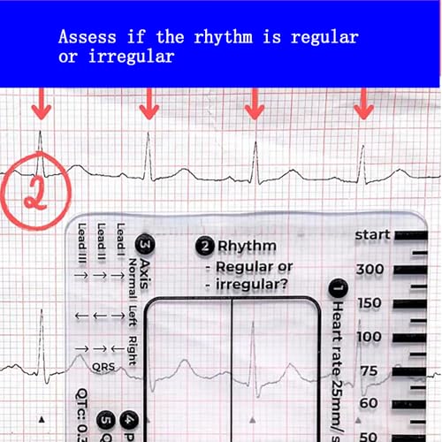 Reglas de ECG de 7 pasos para el bolsillo de la bata en pases de guardia 4
