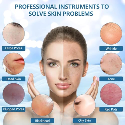 Image of AJIGNA MART Skin Scrubber, Ultrasonic Exfoliator 3 Modes, Blackhead Remover, Pore Cleaner, Face Wash Spatula with 3 Modes, Face Skin Spatula USB Charging, Suitable for All Skin Types