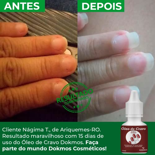 Óleo De Cravo E Melaleuca Dokmos Unha Fraca Quebradiça