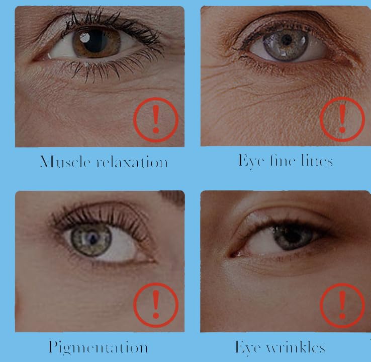 Amazon.com: Eye Line Eraser Cream - Anti Aging Wrinkle Treatment