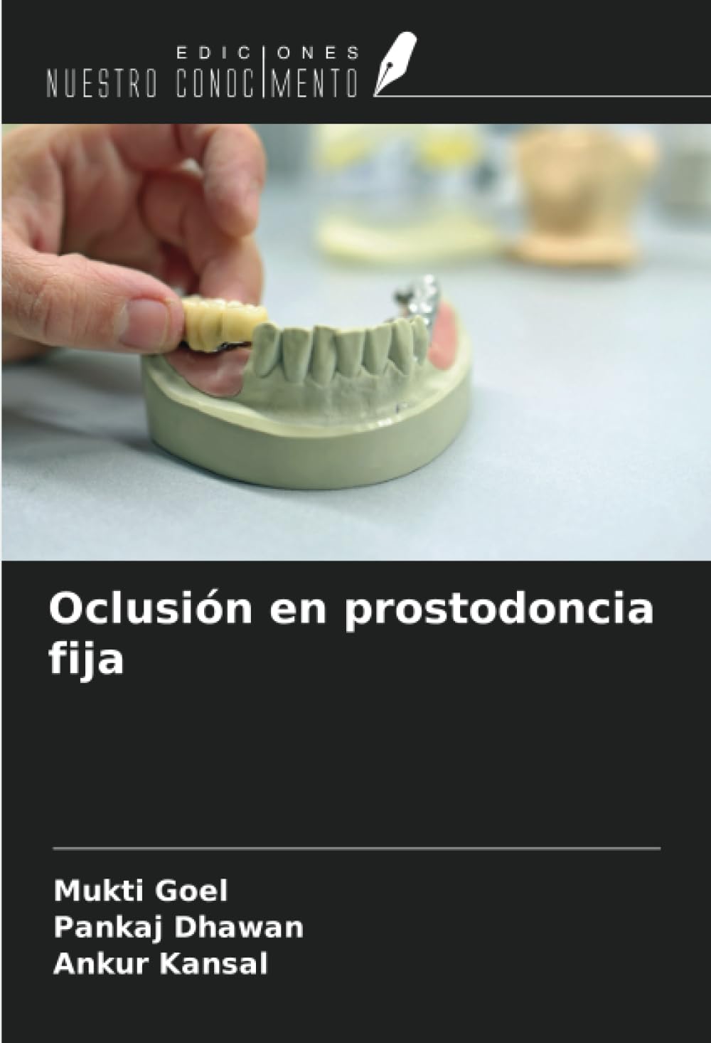 Oclusión en prostodoncia fija (Spanish Edition)