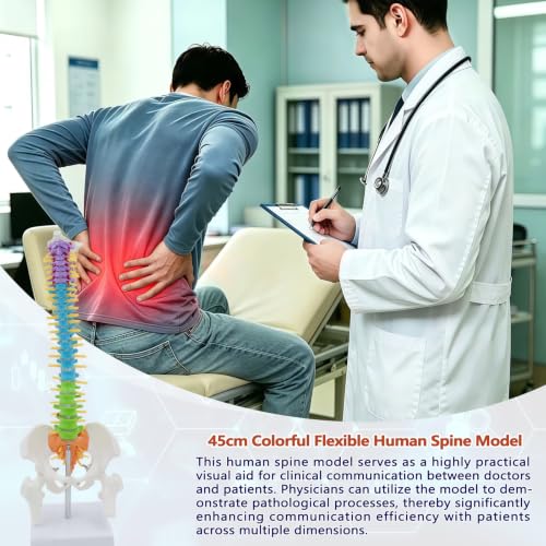 Image of Mini Flexible Human Spine Model with Pelvis and Nerve Roots,13.8 inch Vertebral Column Model for Instruction Teaching, Patient Demonstration, Education(Multicolour)