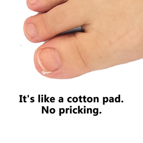 Miniatura 5 de Tratamiento de uñas encarnadas, 50 tiras correctoras de uñas encarnadas transparentes, herramienta profesional de tratamiento de uñas sin pegamento