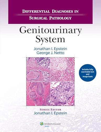Differential Diagnoses in Surgical Pathology: Genitourinary System - //medicalbooks.filipinodoctors.org