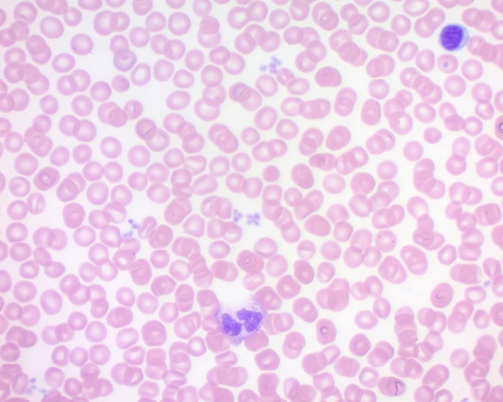 Wright-Giemsa Stain Pack, 500ml