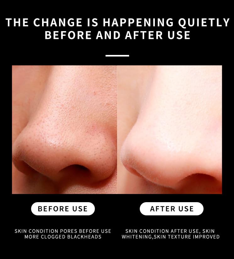 Miniatura 4 de Parche de nariz para eliminar puntos negros (10 piezas), limpia profundamente los poros, puntos negros, adecuado tanto para hombres como para