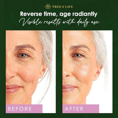 Tree of Life Retinol Serum for Face...
