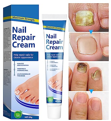 Fungal Nail Treatment Cream - Antifungal Cream Nail Fungus Treatment for Toenail, Effective Nail Repair Cream for Thick Cracked Discolored Nails, Extra Strength